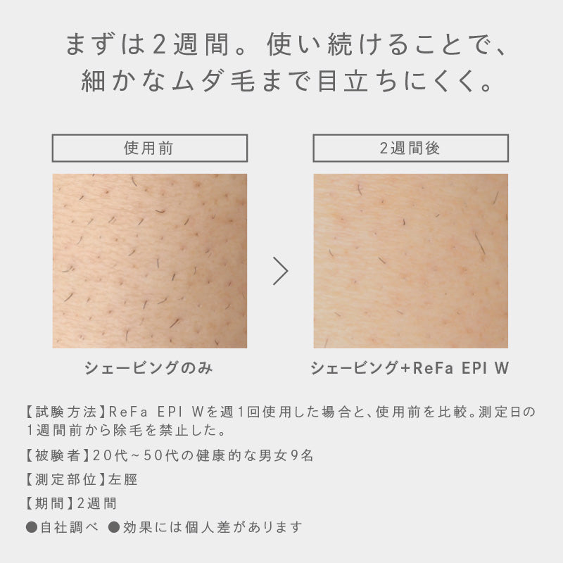 リファエピダブル