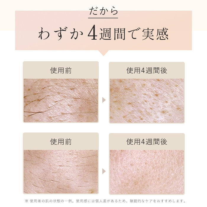 STELLA BEAUT ステラボーテ IPL光美容器 Luna